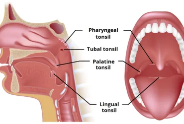 Can Tonsils Grow Back After Being Removed? – Tymoff